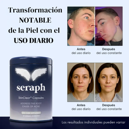 Seraph SkinClear™ – Belleza desde el interior