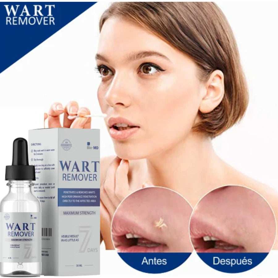 Wart Remover - Remueve las verrugas en 7 dias