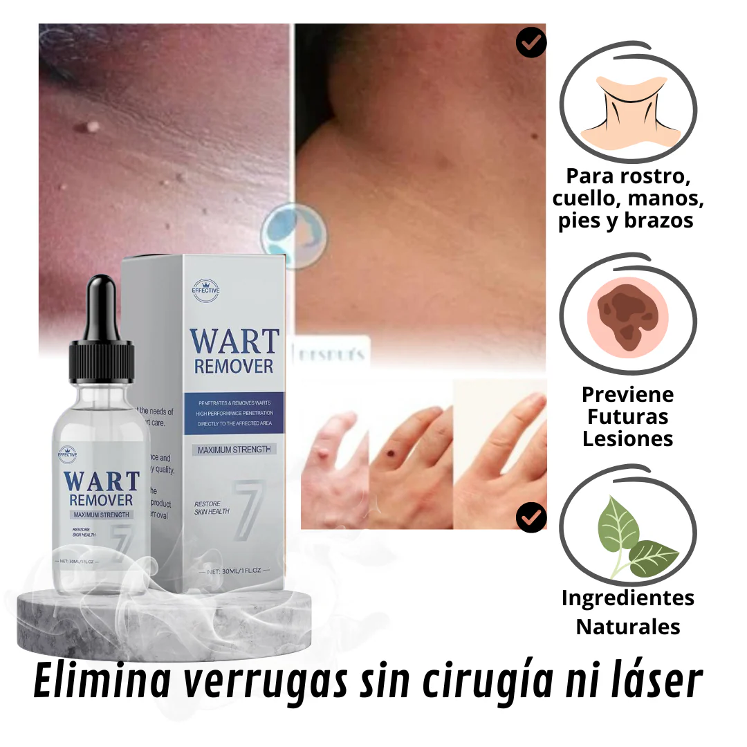 Wart Remover - Remueve las verrugas en 7 dias